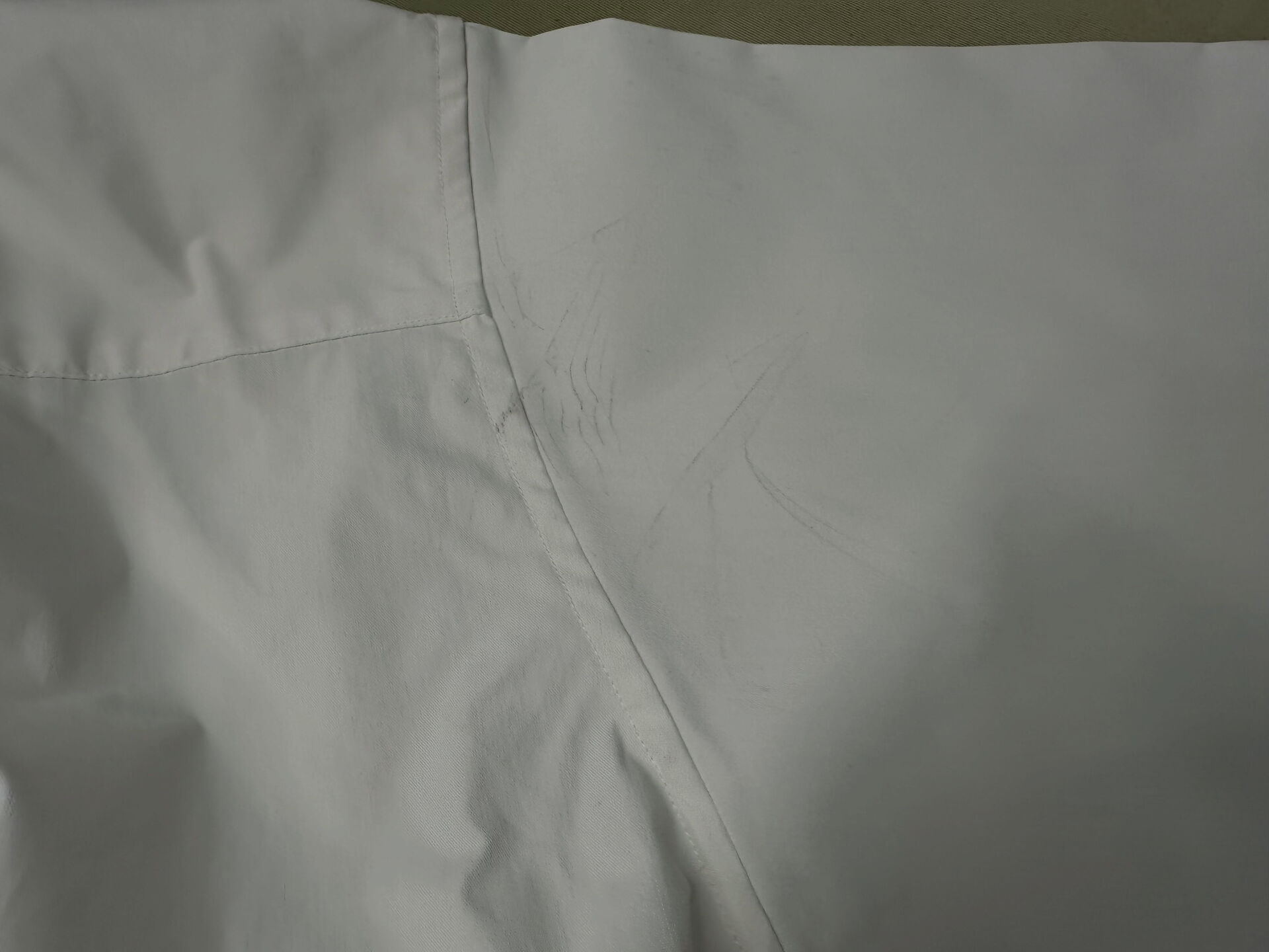 気になるシミはお任せください👔✨